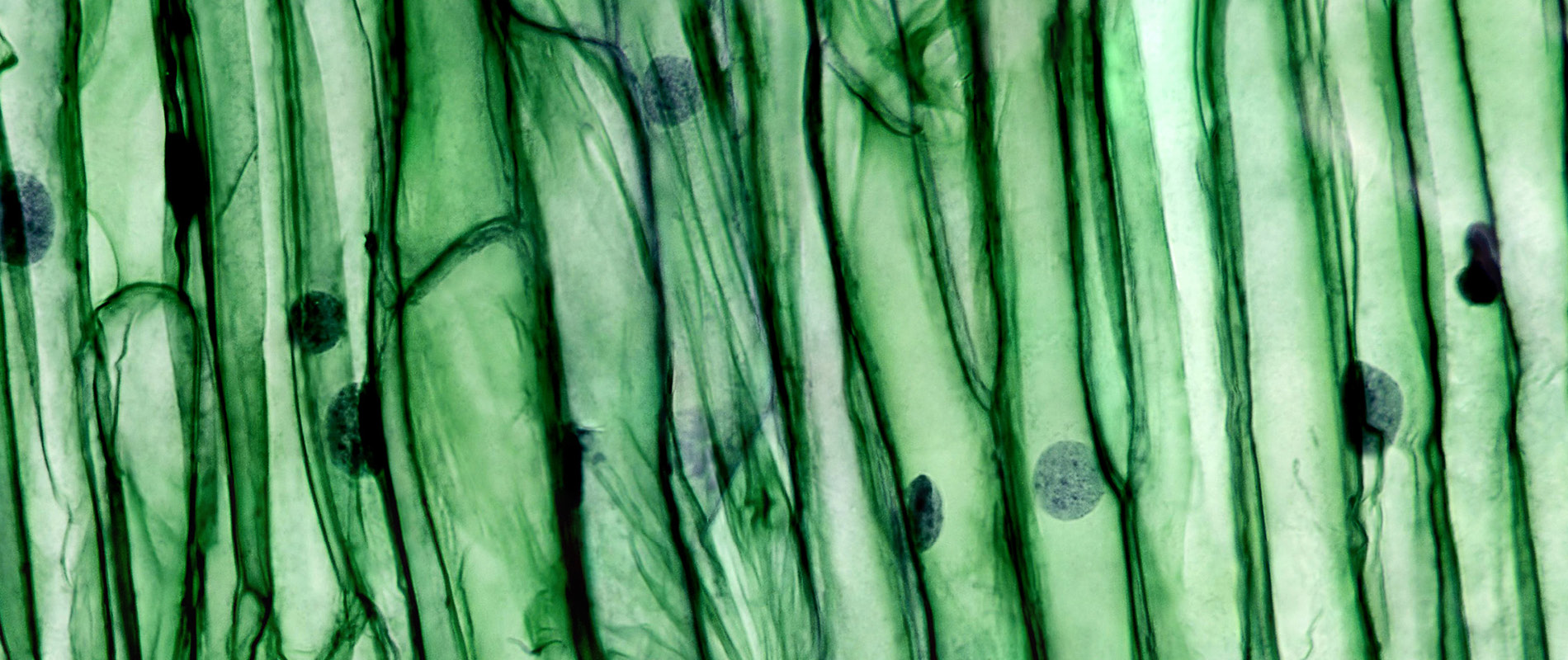 Mikroskopische Vergrerung von Pflanzenzellen
