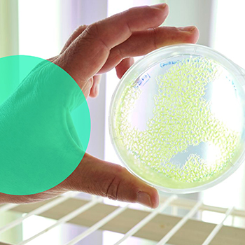 Hand holding a Petri dish with nutrient solution